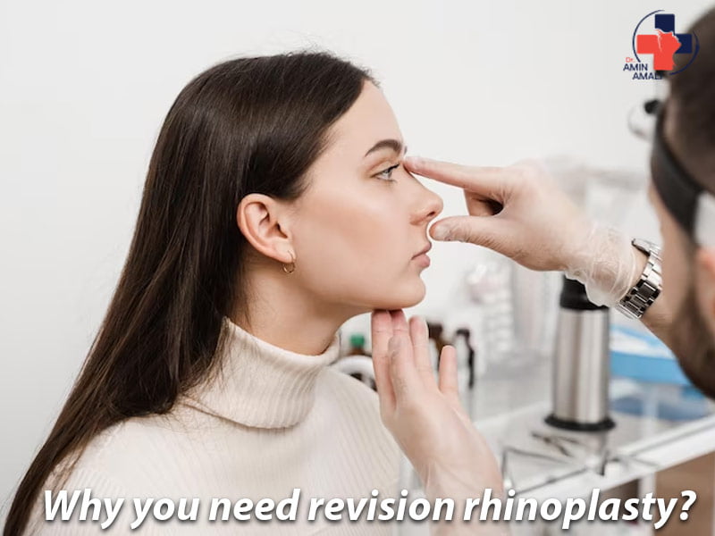 revision rhinoplasty - www.draminamali-en.com/