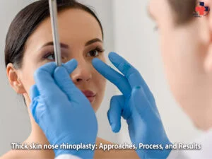 Thick skin nose rhinoplasty www.draminamali-en.com/