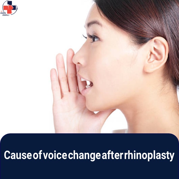 voice change after rhinoplasty