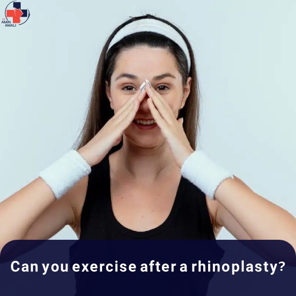 Can you exercise after rhinoplasty?